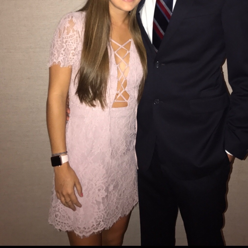 Tobi Lace Party Dress 💃🏻